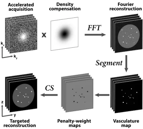 Figure 2.1: Proposed reconstruction strategy. Angiograms with variable-density undersampling in k-space are density-compensated and transformed to obtain Fourier reconstructions (ZF)