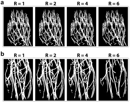 Figure 2.3: Vasculature maps were segmented from undersampled angiograms at acceleration factors R = 1-6
