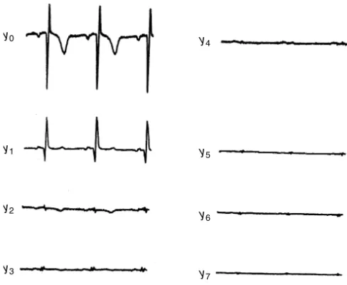 FIGURE 3.5 Uncorrelated signals y i , i = 0, 1, 2, . . . , 7, corresponding to the ECG signals shown in Figure 3.4.