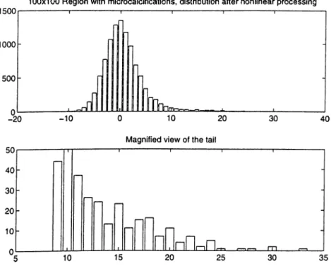 Figure  2.16:  100x100  region  with  microcalcifications,  distribution  after  nonlinear processing  and  magnified  view  of the  tail.