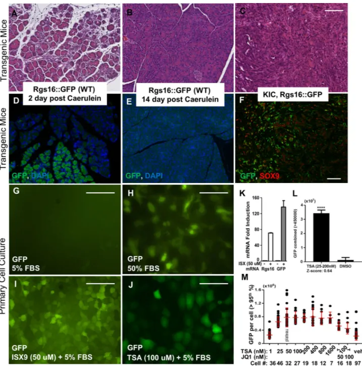 Figure 2.  Rgs16::GFP expression is induced by HDAC and HAT inhibitors. Hematoxylin and eosin staining  of pancreas sections from (A) Rgs16::GFP mouse 2 days post caerulein, (B) Rgs16::GFP mouse 14 days post  caerulein, and (C) KIC mice tumor