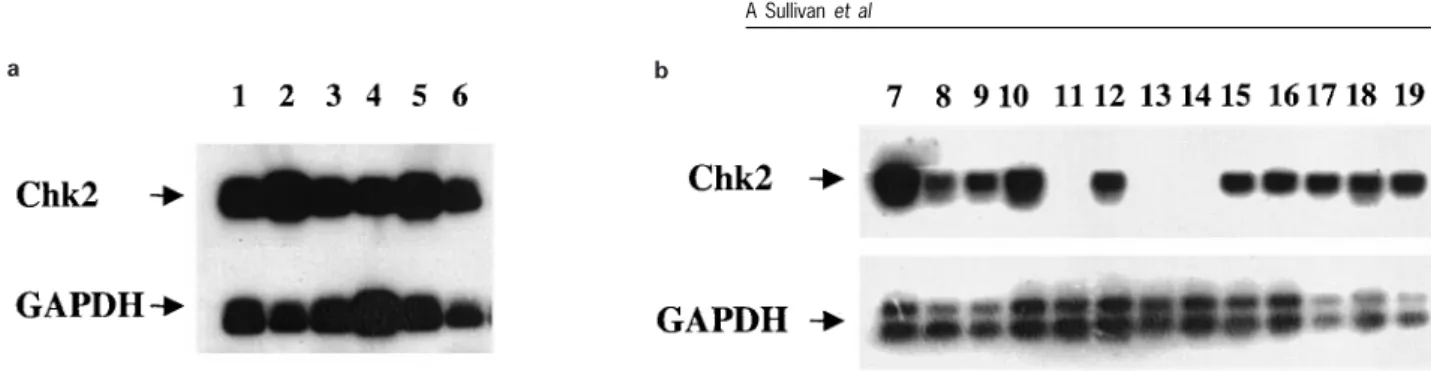 Table 2 Immunocytochemical analysis of Chk2 expression in normal breast tissue (a) Proportion of cells positive (b) Intensity of staining