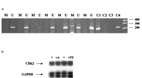 Table 3 Immunocytochemical analysis of Chk2 expression in breast carcinoma