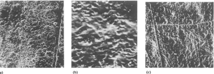 Fig.  1.  SEM  micrographs  of  the  electrolytic  film:  (a)  electrode  side;  (b)  solution  side;  (c)  film  washed  with  CHCI 3 for  several  weeks