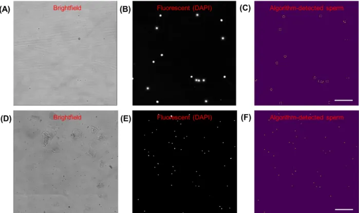 Fig. 2. Microscope images of sperm cells on chip, stained with DAPI. Scale bar = 50 μm, magnification = 200×