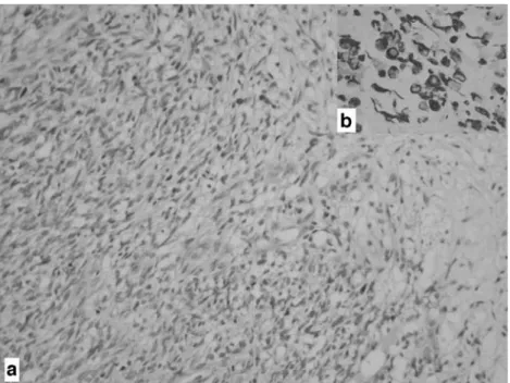 Fig. 6 a Axial image shows the reduced dimensions of  rhabdo-myosarcoma (black arrow).