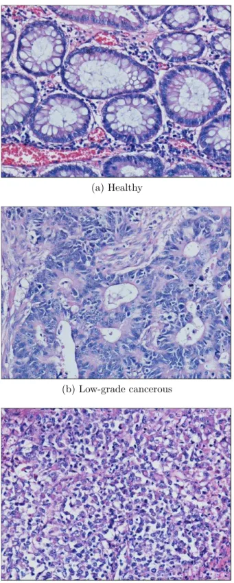 Figure 3.2: Colon tissue samples
