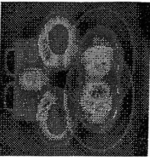 Figure  3.27:  Addition  o f the  images