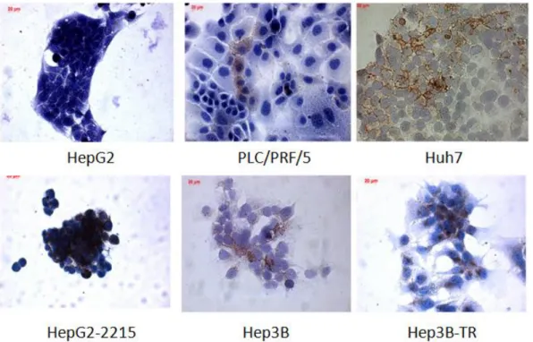 Figure  3.2:  Six  HCC  cell  lines  were  detected  to  be  positive  for  CD133  expression