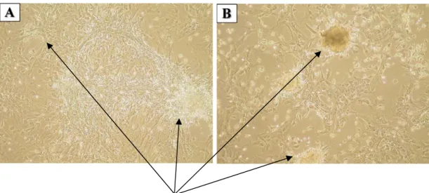 Figure 4.2A and 2B – Appearance of MSC colonies at different passages; left picture shows P1  MSCs, right one P2 MSCs