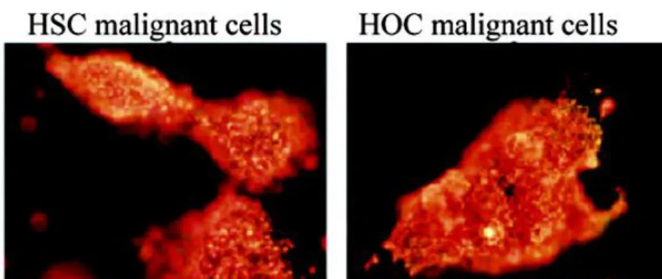 Figure 6. The photothermal therapy of malignant cells with anti-EGFR/Au by applying Ti: 