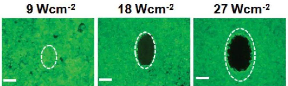 Figure 7. Photothermal therapy of A549 malignant cells with anti-EGFR/ Au by using NIR  CW lasers