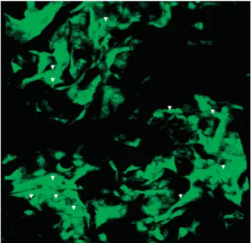 Figure 10. SEM micrographs of the top (initial seeding site) of 3T3 seeded P(L/DL)LA-PHBV foams on (a) Day 7 and (b) Day 14 (⫻350, arrow heads indicate cells).