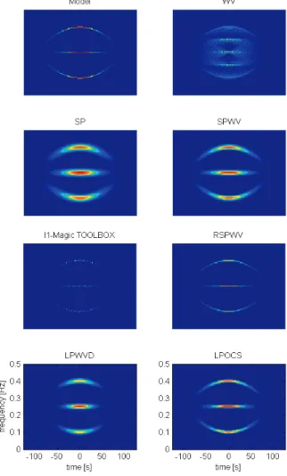 Fig. 6. Example 1: TF reconstruction using various methods. Left column: Ideal model, spectrogram, l 1 -MAGIC TOOLBOX, L-class polynomial WV distribution (LPWVD); right column: WV distribution,