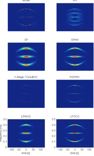 Fig. 6. Example 1: TF reconstruction using various methods. Left column: Ideal model, spectrogram, l 1 -MAGIC TOOLBOX, L-class polynomial WV distribution (LPWVD); right column: WV distribution,
