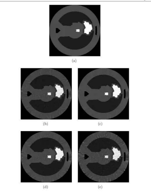 Figure 6. (a) Original distribution. The other frames are reconstructed thorax images for different current injection strategies with SNR MR = 20 noise case for (b) opposite current, (c) cosine, same maximum current, (d) cosine, same total power and (e) co