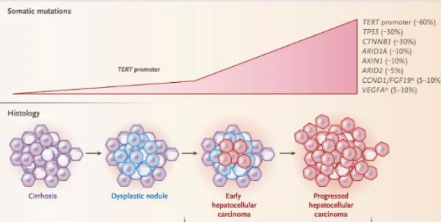 Figure  1.2:  Molecular  alterations  contributing  to  HCC  development.  Reproduced  with  permission from Villanueva, 2019, Copyright Massachusetts Medical Society