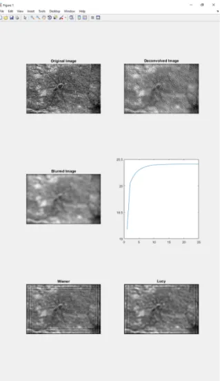 Fig. 5. Deconvolution results of an image with high total variation values. The PSNR result of the presented software (20.40 dB) is not as good as the results of Wiener (20.60 dB) or Lucy–Richardson deconvolutions (20.51 dB)