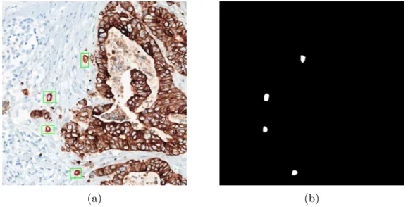 Figure 3.2: The input and output for an example image tile. (a) 2048 × 2048 RGB image tile cropped from an whole slide image where tumor bud bounding box annotations are drawn on the image tile