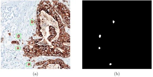 Figure 3.2: The input and output for an example image tile. (a) 2048 × 2048 RGB image tile cropped from an whole slide image where tumor bud bounding box annotations are drawn on the image tile