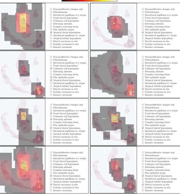 Figure 3.1: Viewing behavior of eight different pathologists on a whole slide image with a size of 74896 × 75568 pixels