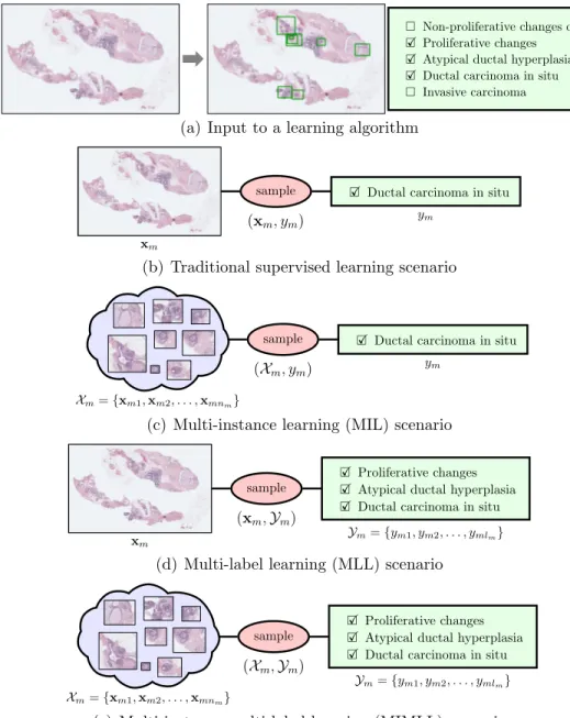 Figure 4.2: Different learning scenarios in the context of whole slide breast histopathology