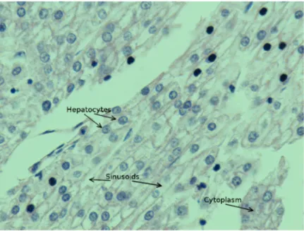 Figure 1.1: Sample HE stained liver tissue.
