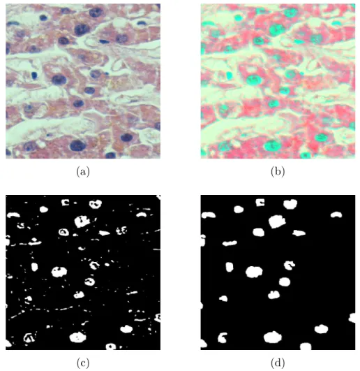 Figure 1.2: An example of a traditional cell segmentation procedure. (a) HE stained liver image