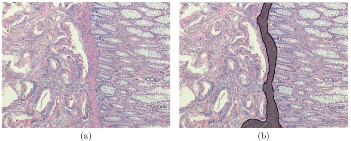 Figure 3.9: A sample image from SegmentationSet: (a) Original image, (b) gold standard version that indicates homogeneous regions.