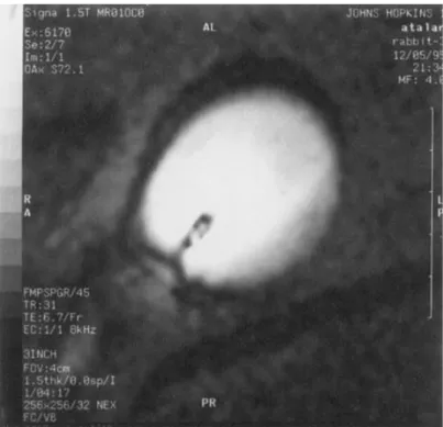 Figure 1.2  A rabbit aorta image obtained by a MRI loopless catheter coil. This image  was taken from Ocali O, Atalar E