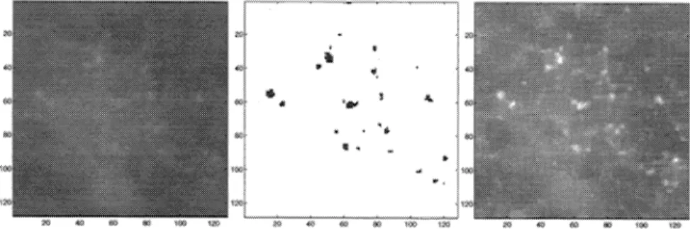 Figure 8: (a) A region of a mammogram image containing microcalcifications, (b) output of the detection scheme (c) enhanced image Ya (the low subband image) in Figure 3.