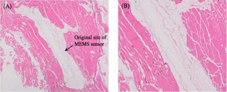 Fig 2.  2x (A) and 4x (B) images of the H&amp;E stained tissue  adjacent to the implanted MEMS sensor