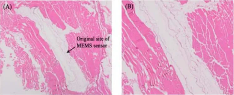 Fig 2.  2x (A) and 4x (B) images of the H&amp;E stained tissue  adjacent to the implanted MEMS sensor