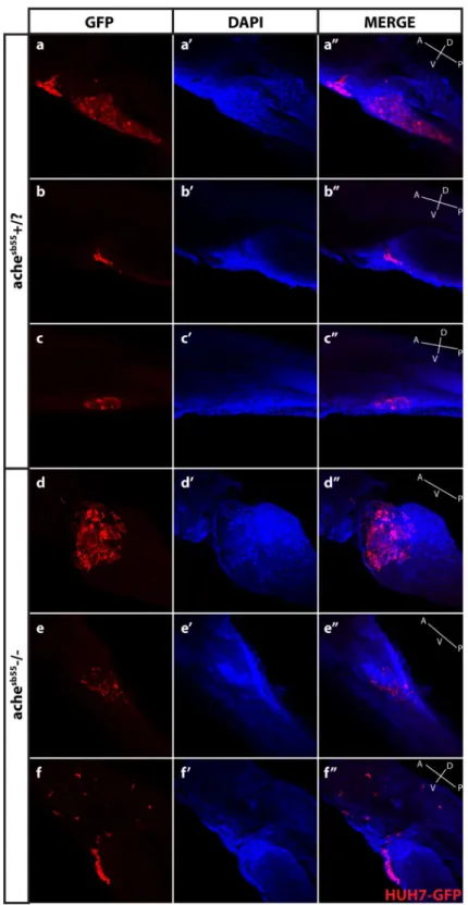Figure 6.  Optical sectioning and examination of Huh7-GFP xenografted larvae. Larvae (ache+/? and  ache−/−) injected with Huh7-GFP cells were stained with GFP primary antibody and Cy3 tagged secondary  antibody, and counterstained with DAPI and examined hi