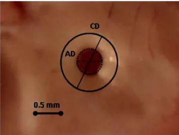 Fig. 2 A brain tissue sample exposed to Tm:YAP laser. CD shows the coagulation diameter and AD shows the ablation diameter