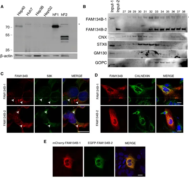 Figure 4. FAM134B isoforms are weakly expressed endogenously in cell lines and differentially localize in         