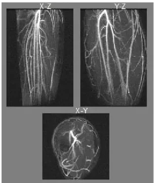 Fig. 4. Three-dimensional image of lower-leg along different cross sections, [8]