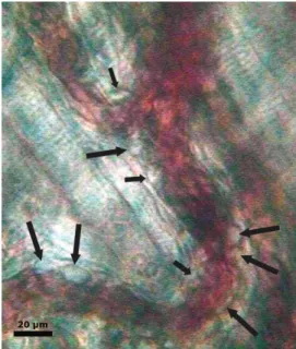 Fig. 2. Intravital videomicroscopic image showing rolling and adherent neutrophils (black arrows) to the postcapillary venules.