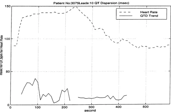 Figure  A. 15:  QTD  and  Heart  Rate  for  patient  3075  ST=-  QT—  A—?
