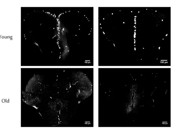Figure 2.5: BrdU positive cells across the telencephalon. Representative immuno- immuno-histochemistry images are seen for each age and treatment group