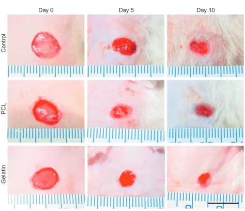 Fig. 8.5 Photographs of full-thickness skin wounds and subsequent wound contraction on days 5 and 10 after treatment with gauze (control), PCL, and gelatin nanofibers