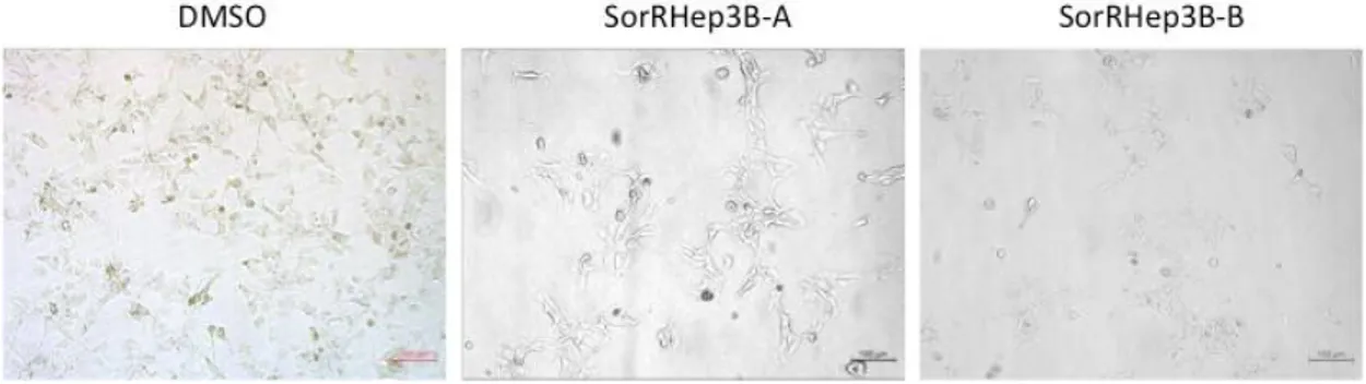 Figure  3.3:  SorRHep3B  cells  are  morphologically  different  than  DMSO  cells.  These  images  are  taken  with  4X  magnification