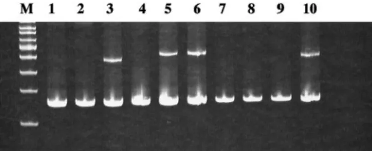 Table 1 Characteristics of oral SCC with and without methylation of ␴ p53 WT a (n ⫽ 55) p53 MT a (n ⫽ 37) P ␴ methylated (n ⫽ 32) 24/55 (0.44) 8/37 (0.56) 0.074 ␴ unmethylated (n ⫽ 60) 31/55 (0.56) 24/55 (0.44) HPV ⫹ve (n ⫽ 17) HPV ⫺ve (n ⫽ 75) P ␴ methyla
