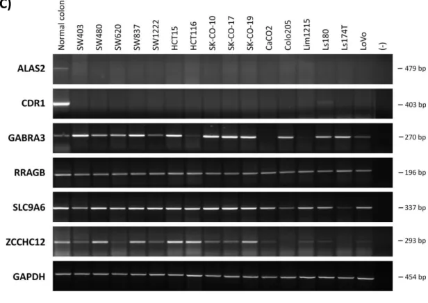 Figure  1  mRNA  expression  levels  of  8  putative  tumor  suppressor  genes  on  X  chromosome  in  normal  tissue  (A),  lung  cancer  (B)  and  colon  cancer  (C)  panels,  by  conventional  RT-PCR