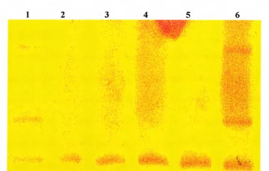Figure 4-2  V erification o f  the heteroduplex analysis technique.  Lanes  1  and 6  are  both  the  known  four  base  pair  deletion  mutant  (patient  2638)