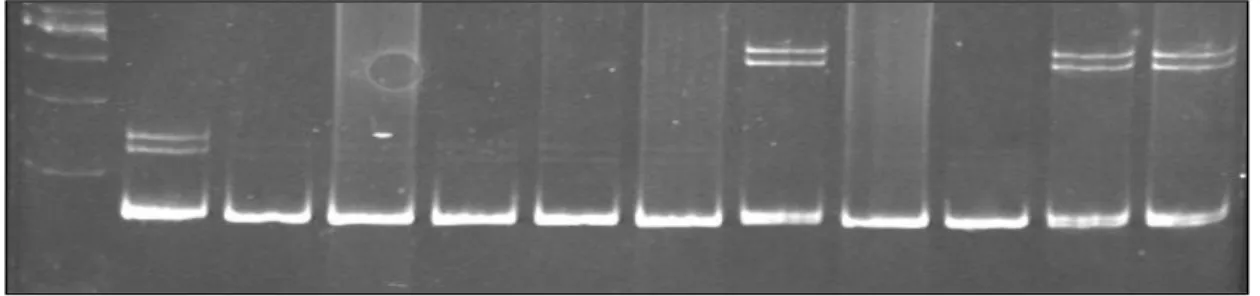 Figure 7: Polyacrylamide gel showing insertions and wild types. Lane1: Molecular  size marker Lane2: Hep 40 cell line with 3bp insertion