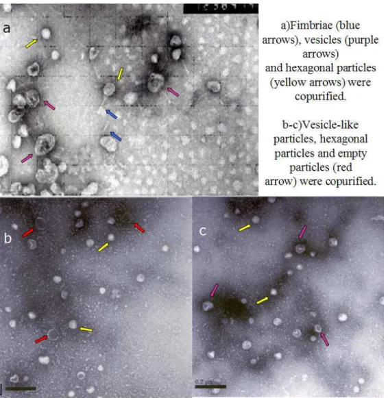 Figure 3.2: (a)Particles isolated over 15% sucrose.(b)Particles isolated over 30%