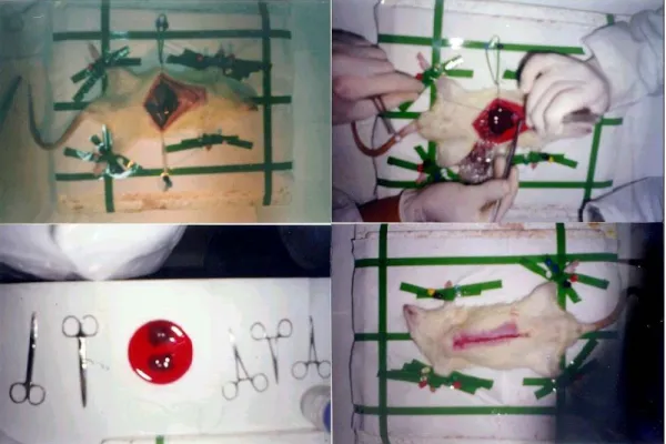 Figure 2.2. The liver resection surgery for partial hepatectomy.  70%