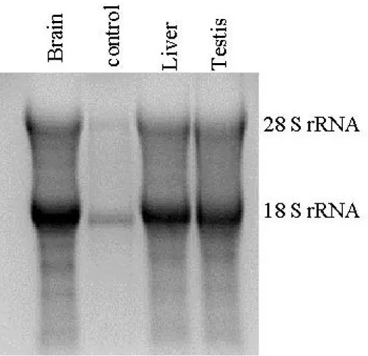 Figure 3.1. Integrity check of RNA samples on denaturing agarose gel. The isolated RNA samples from Brain, Liver and Testes were electrophoresed in 1.2%