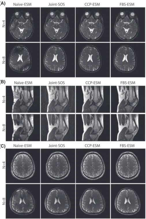 FIGURE 6 (a) In vivo bSSFP acquisitions of the brain were performed with D = 4 (Dataset#2) (b) In vivo bSSFP acquisitions of the knee were performed with D = 15 (Dataset#3) 
